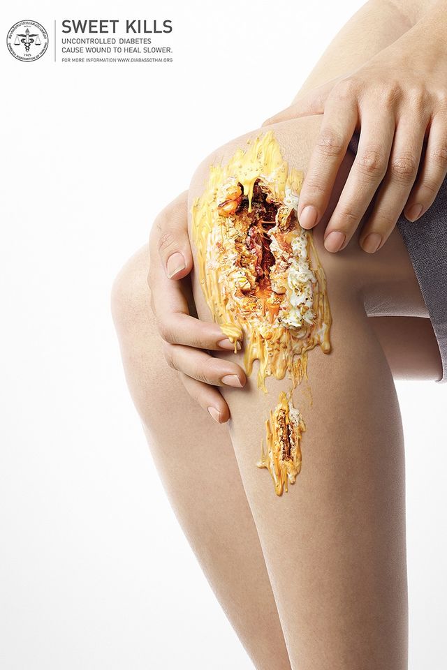 Що відбувається з тілом під впливом цукру: шокуючі зображення - фото 159277