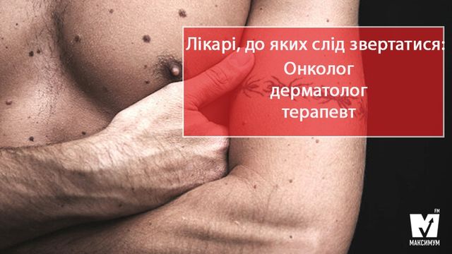 Прихована загроза: як перевіряти родимки і чи потрібно їх видаляти - фото 157630