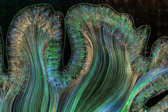 Це варто побачити: автопортрет мозку людини - фото 170501