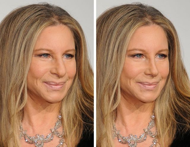 Як змінилася б зовнішність зірок, якщо їх позбавити "родзинки" - фото 165551