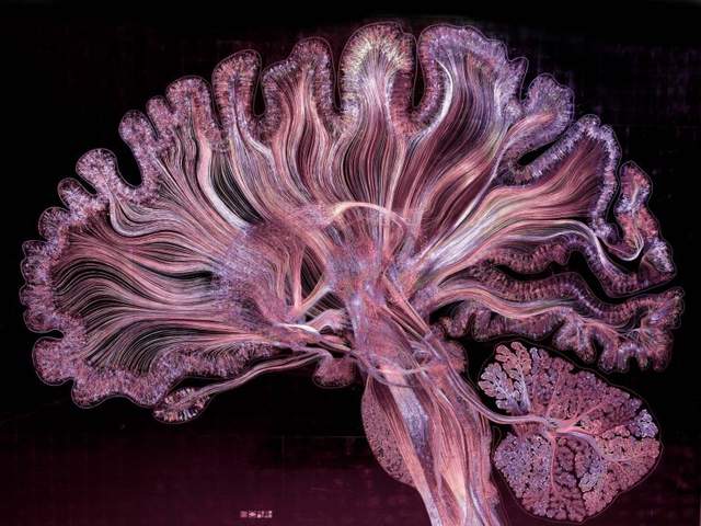 Це варто побачити: автопортрет мозку людини - фото 170504