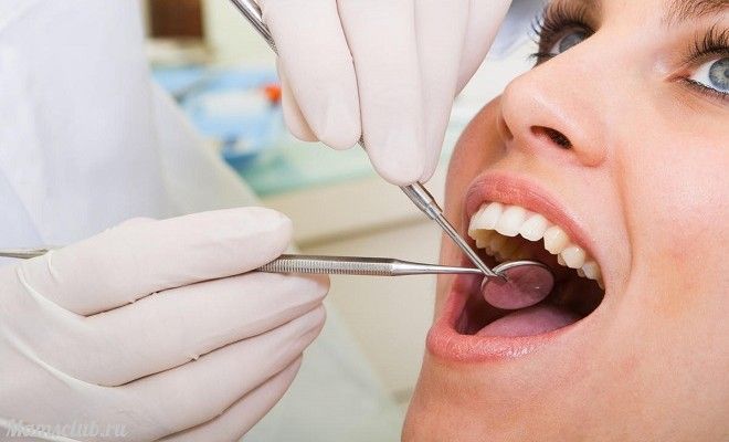 5 міфів про догляд за зубами, які варто забути