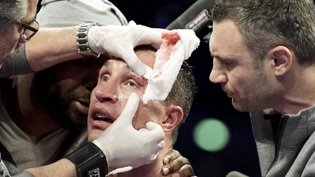 Як Кличку розсікли брову - фото 163978