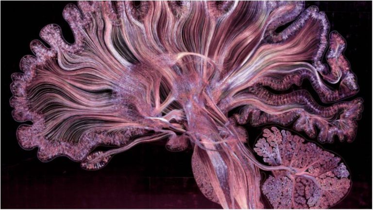 Це варто побачити: автопортрет мозку людини