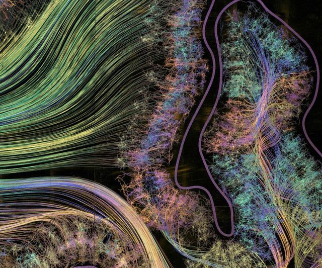 Це варто побачити: автопортрет мозку людини - фото 170499