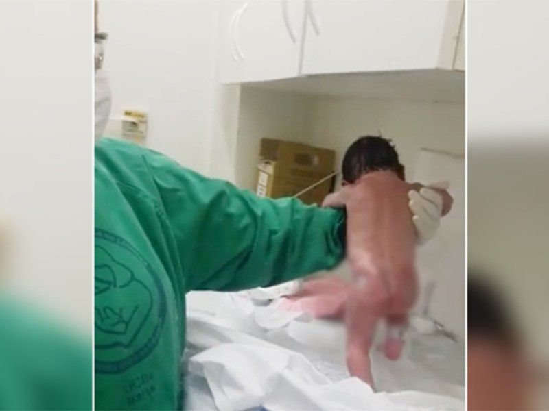 Новонароджене немовля зробило перші кроки одразу після пологів