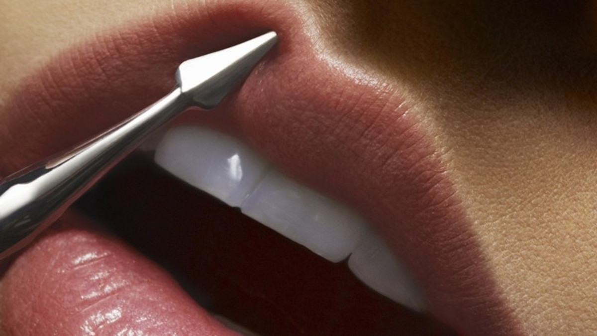 Вшивання губ: новий тренд в пластичній хірургії - фото 1