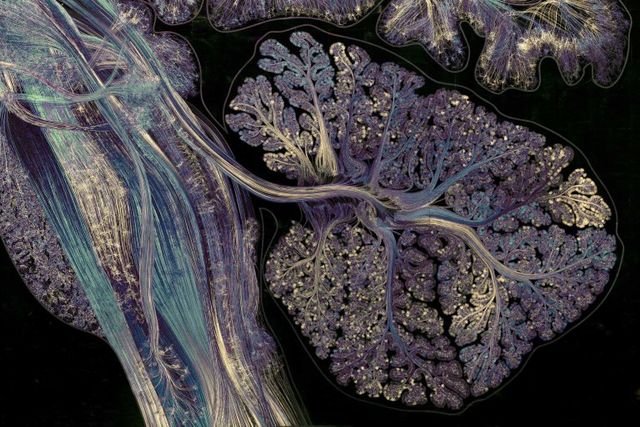 Це варто побачити: автопортрет мозку людини - фото 170503