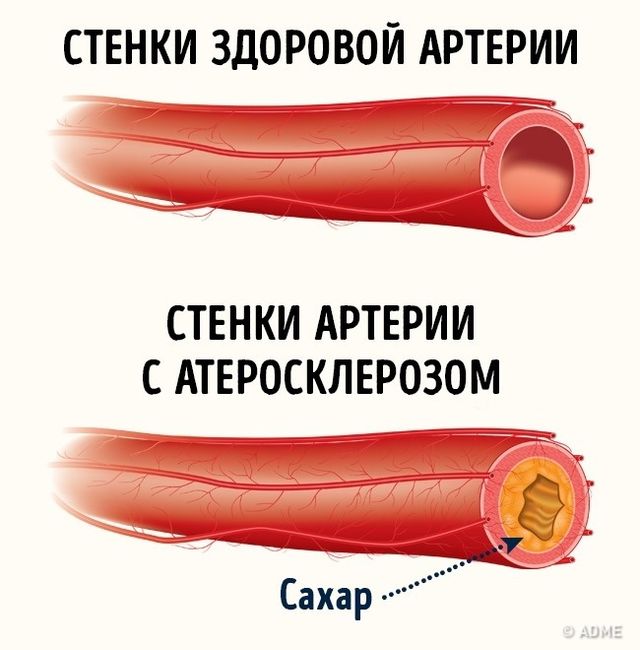 4 небезпечні властивості цукру, про які ми не підозрювали - фото 171668
