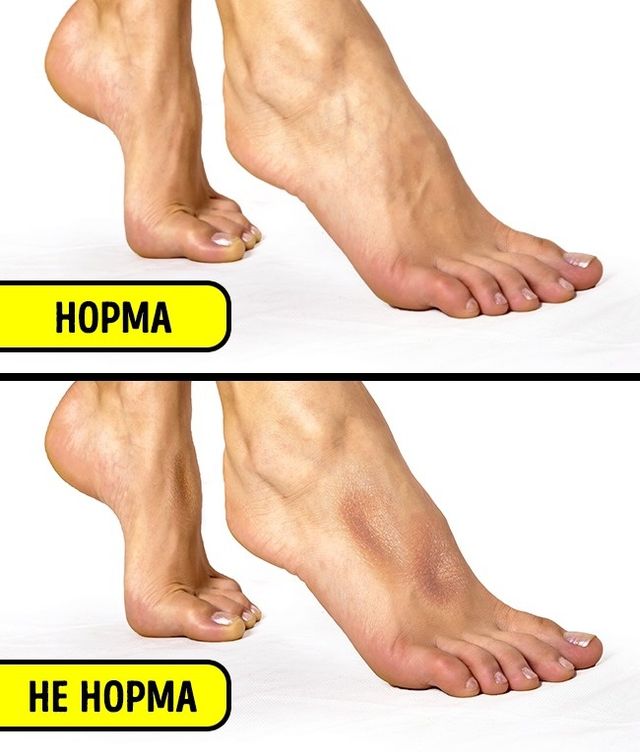 6 простих тестів, які перевірять стан вашого здоров'я - фото 174202