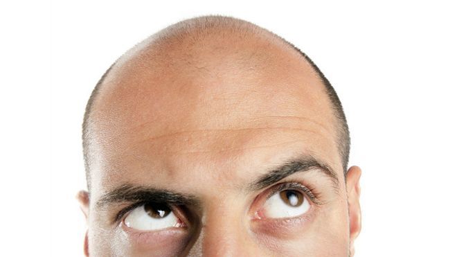 У Мозамбіку полюють за лисими чоловіками