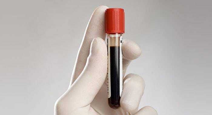 Група крові, яка зменшує ризик розвитку серцевих захворювань