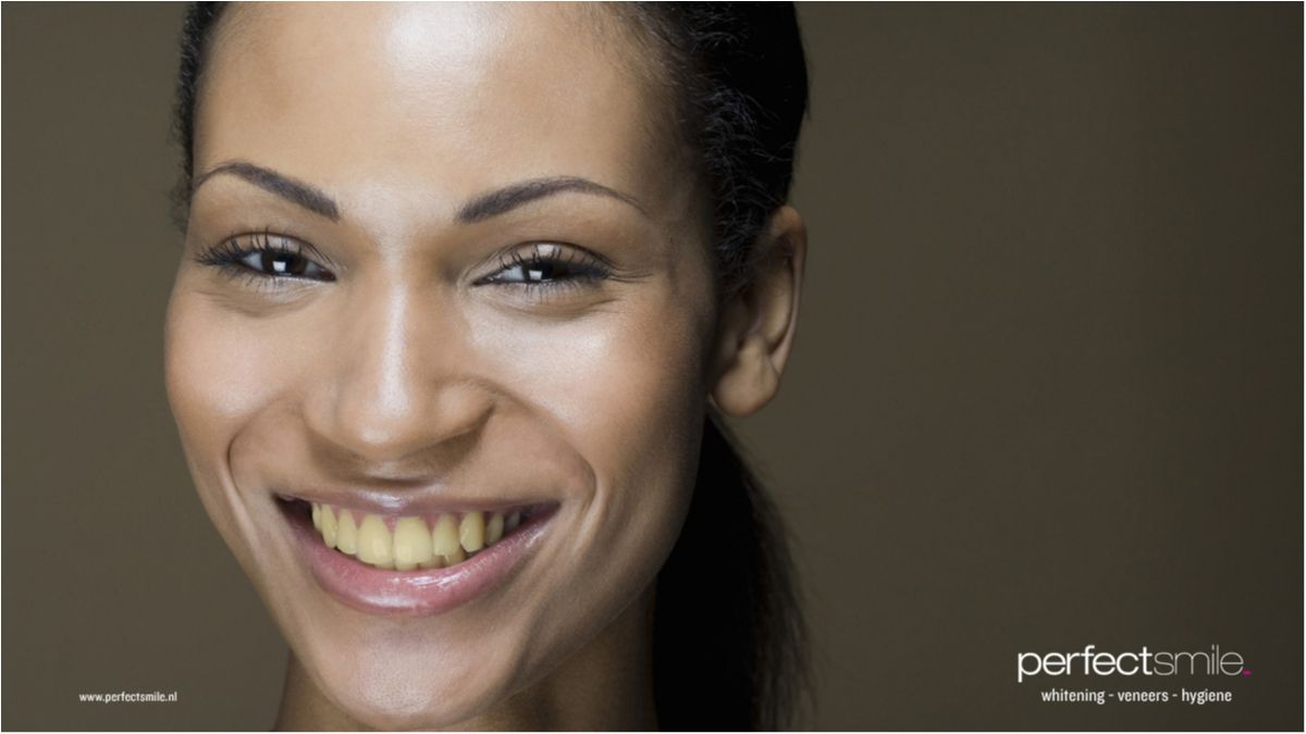 Названо головну причину жовтих зубів