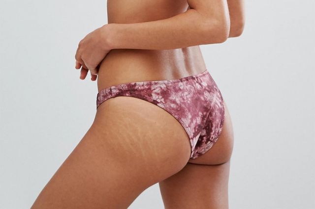 У рекламі купальників Asos з'явилися нетипові моделі: фотофакт - фото 178664