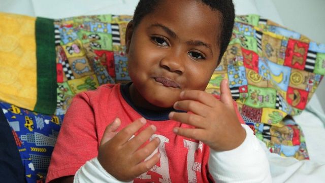 Лікарі вперше в світі пересадили дві руки дитині - фото 182853