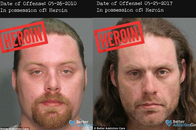 Як наркотики впливають на зовнішність людей: фото "до" і "після" - фото 182633