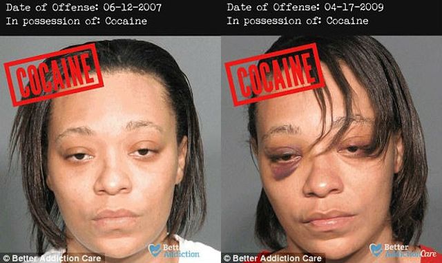 Як наркотики впливають на зовнішність людей: фото "до" і "після" - фото 182638