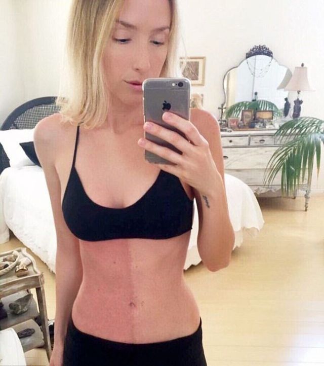 Американка з двоколірною шкірою є сама собі близнюком - фото 178264