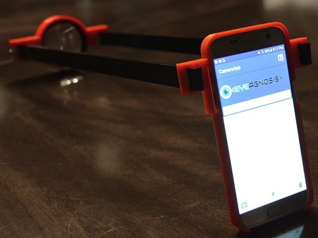Школярка з США створила додаток, який дозволяє виявити проблеми з зором - фото 187535