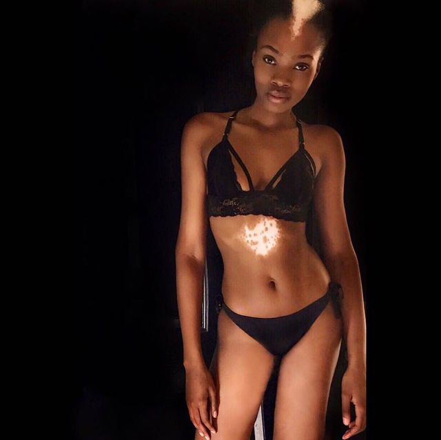 Цю дівчину називали скунсом, але це не завадило їй стати моделлю - фото 186589