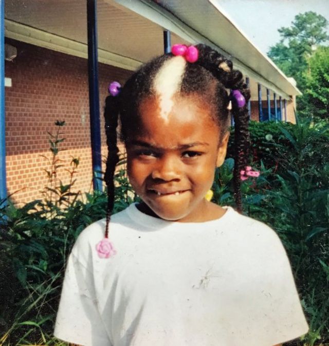 Цю дівчину називали скунсом, але це не завадило їй стати моделлю - фото 186588