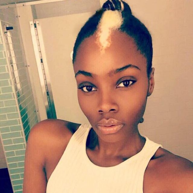 Цю дівчину називали скунсом, але це не завадило їй стати моделлю - фото 186587