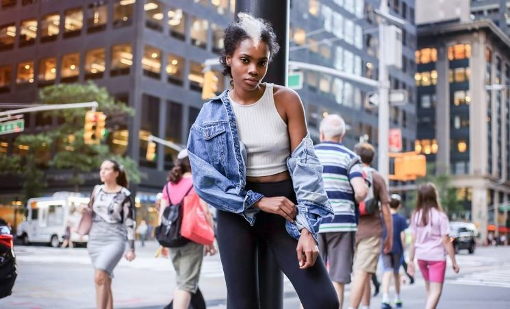 Цю дівчину називали скунсом, але це не завадило їй стати моделлю