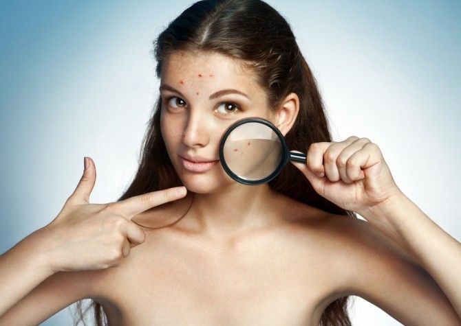 Як смартфон впливає на вашу шкіру