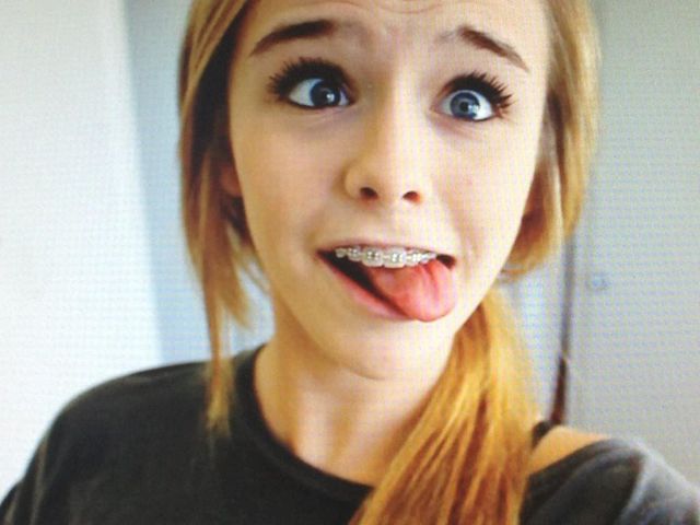 8 найпоширеніших міфів про брекети, у які ви досі вірите - фото 194815