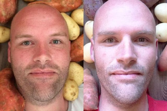 Цей чоловік протягом року їв лише картоплю, і ось що з цього вийшло - фото 197543