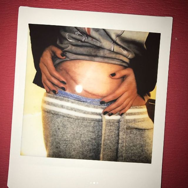 Шрами від операції - фото 196105