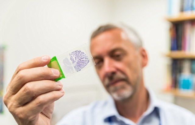 Не для слабкодухих! Як виглядає банк мізків у Лондоні - фото 202417