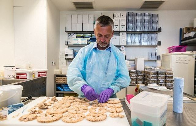 Не для слабкодухих! Як виглядає банк мізків у Лондоні - фото 202420