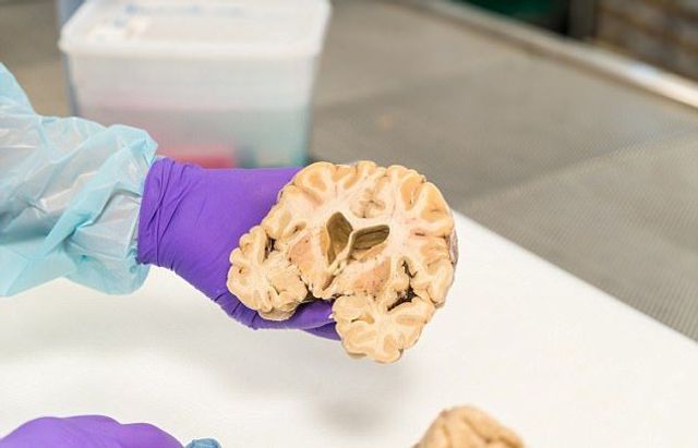 Не для слабкодухих! Як виглядає банк мізків у Лондоні - фото 202419