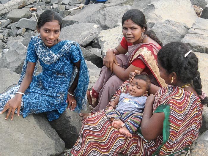 В Індії народився хлопчик з мозком назовні