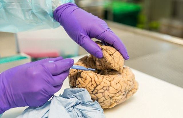 Не для слабкодухих! Як виглядає банк мізків у Лондоні - фото 202421