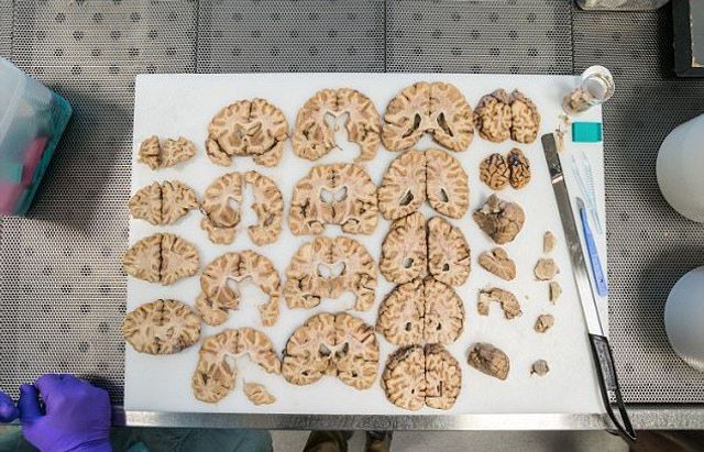 Не для слабкодухих! Як виглядає банк мізків у Лондоні - фото 202418