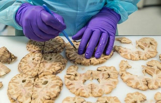 Не для слабкодухих! Як виглядає банк мізків у Лондоні - фото 202422