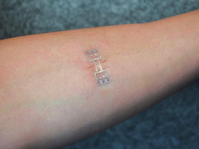 Смарт-пластир microMend швидко залікує рани на шкірі - фото 208617