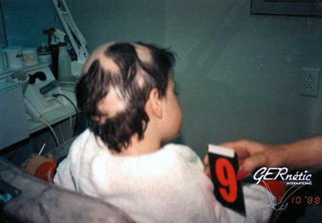 Чернівецька епідемія - фото 206073