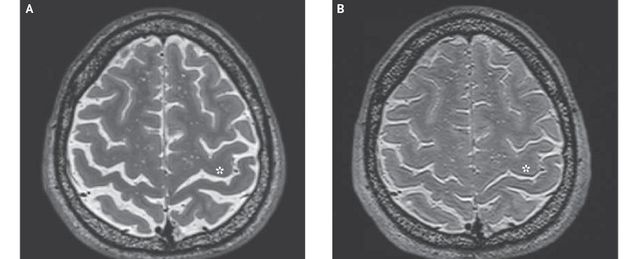 Вчені дізналися як на мозок космонавтів впливають польоти - фото 206687