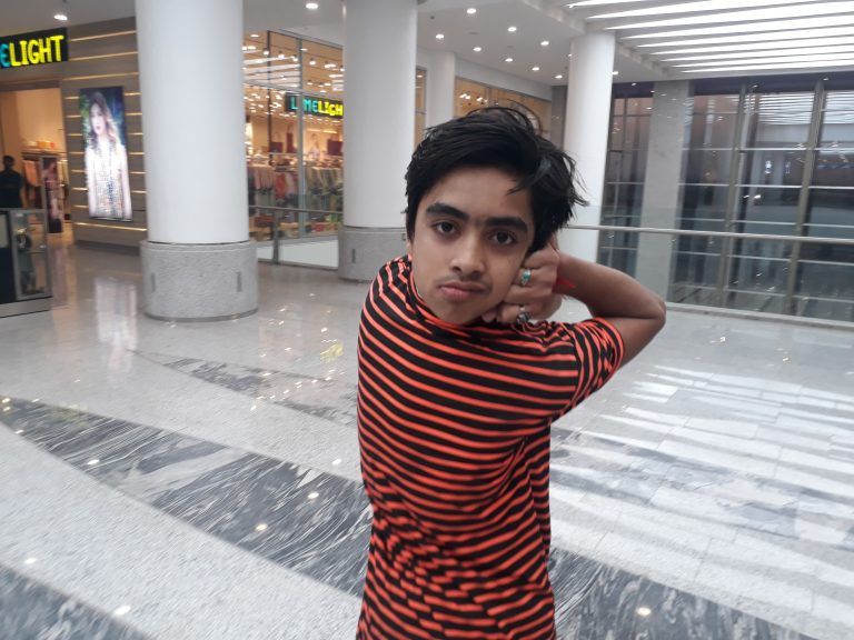 Цей хлопець вміє повертати голову на 180 градусів: шокуючі фото та відео