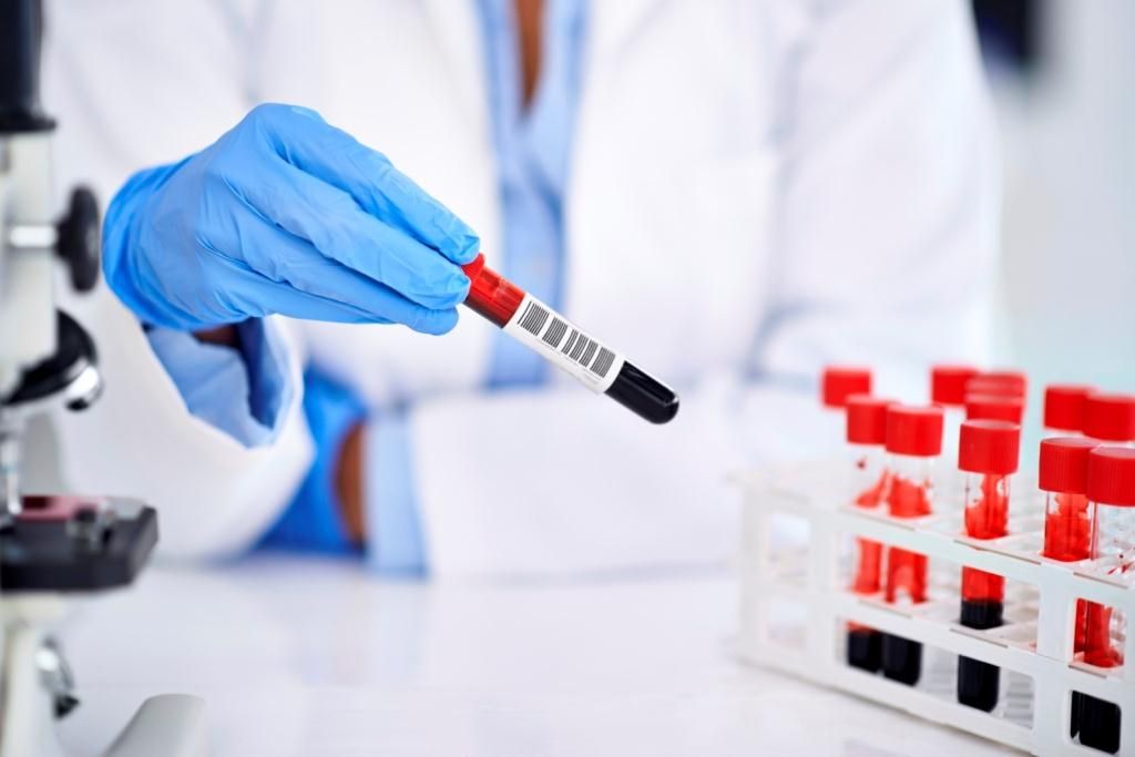 Аналіз крові виявить схильність до самогубства