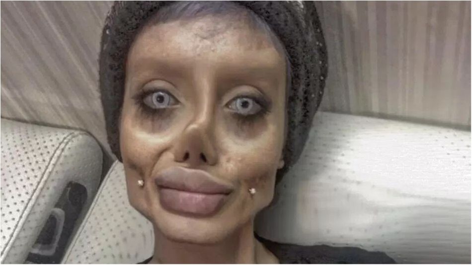 Дівчина зробила 50 операцій, щоб перетворитися на Анджеліну Джолі