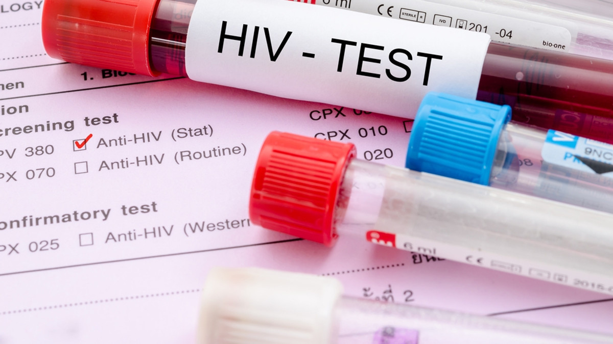 Пройти тест на ВІЛ можна онлайн - фото 1