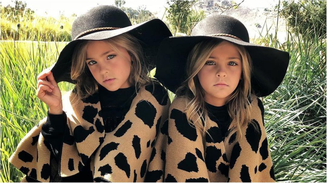 У мережі показали найкрасивіших у світі близнят