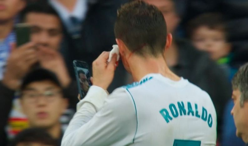 Роналду влучили бутсою в голову - фото 1