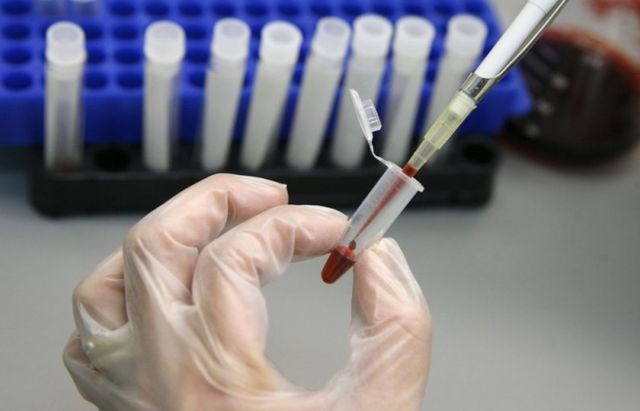 У Миколаївській області зафіксували 47 осіб з гепатитом А - фото 219289