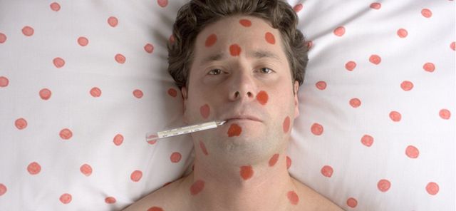 Кір у дорослих - фото 219941