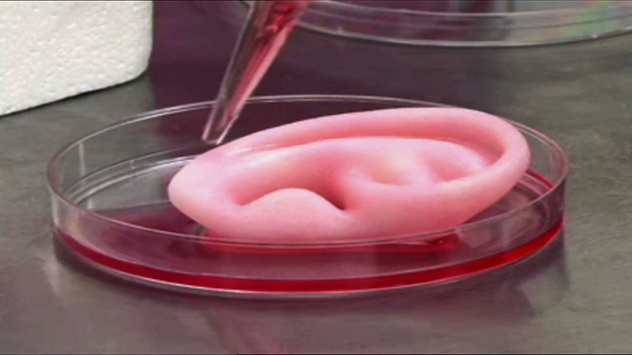 Учені пересадили дітям вуха, вирощені в лабораторії - фото 1